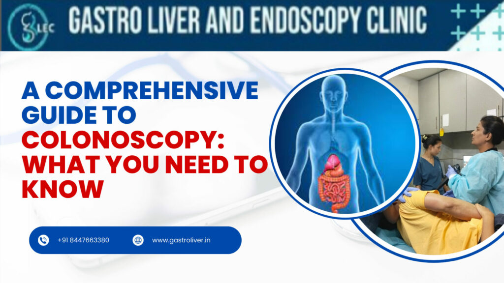 a comprehensive guide to colonoscopy what you need to know