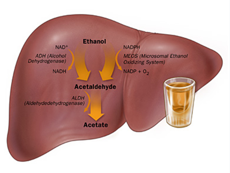 Alcoholic Liver Disease Causes Symptoms And Treatment Gastroliver